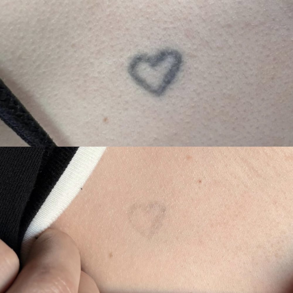 Před a po – Arina V.