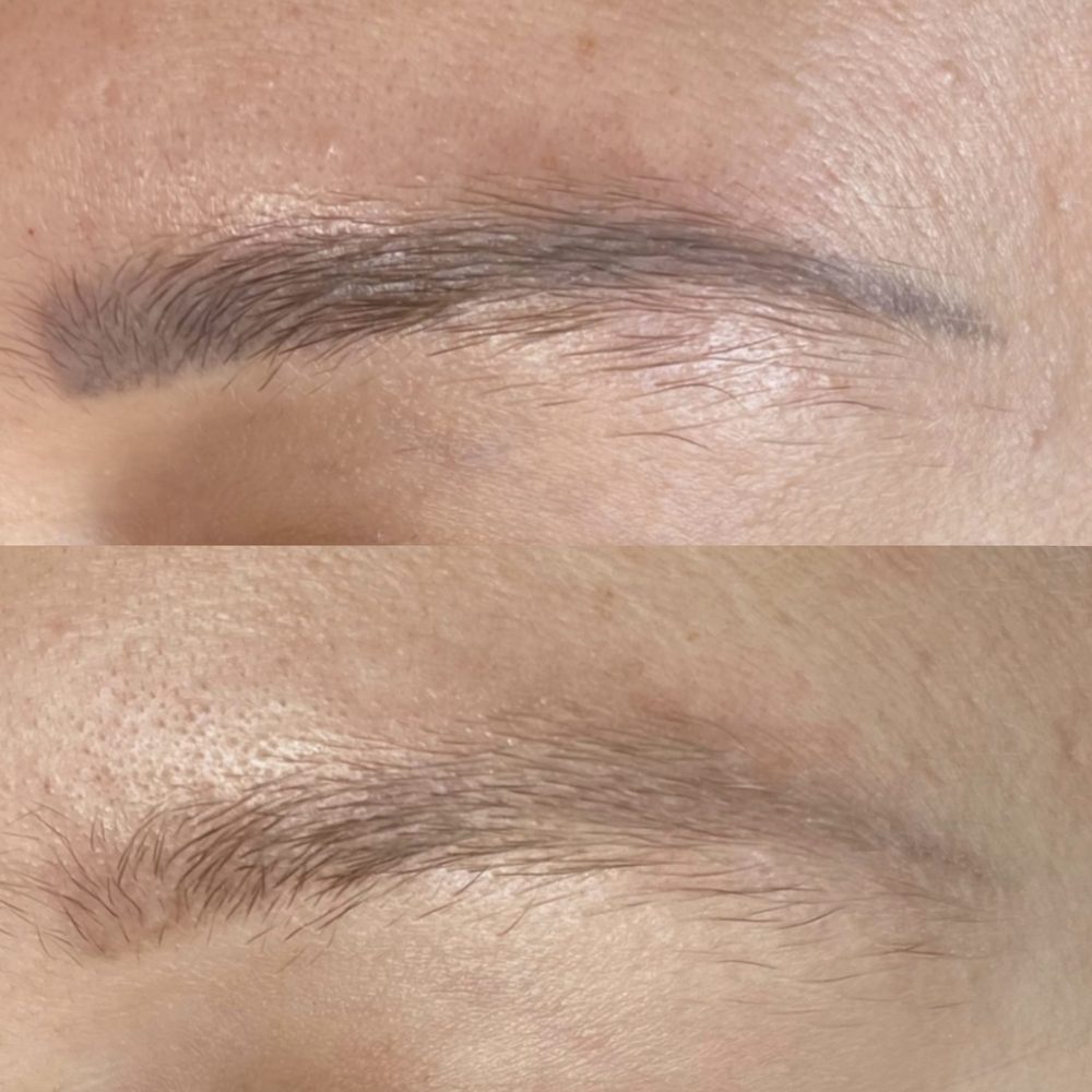 Před a po – Pavlína M.