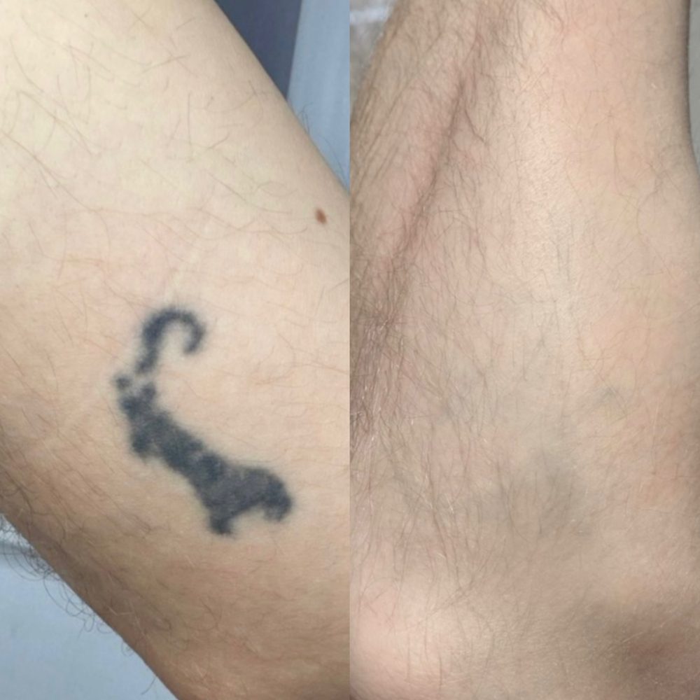 Před a po – Dominik P.