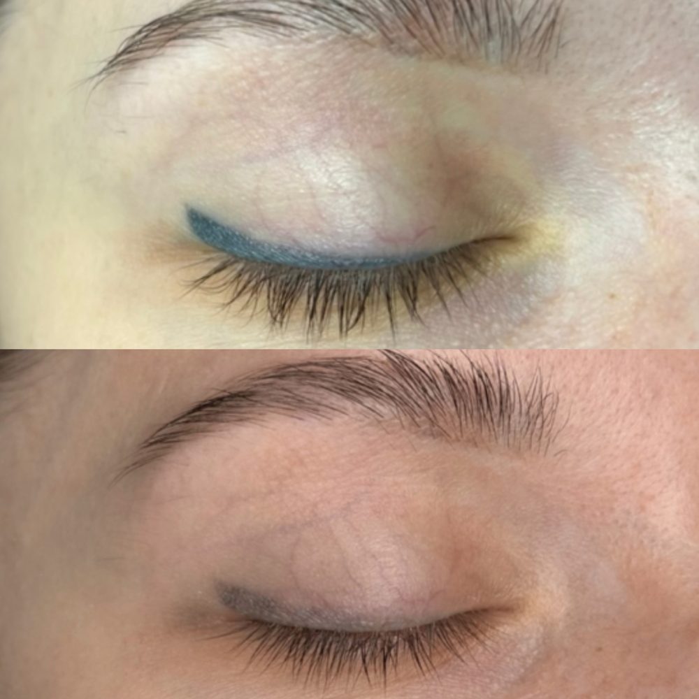 Před a po – Veronika K.